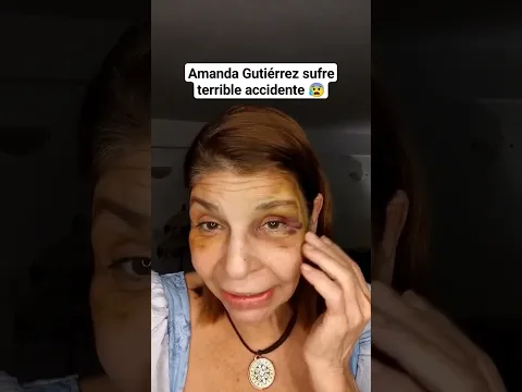 La actriz Amanda Gutiérrez sufrió un terrible accidente en su casa 😰
